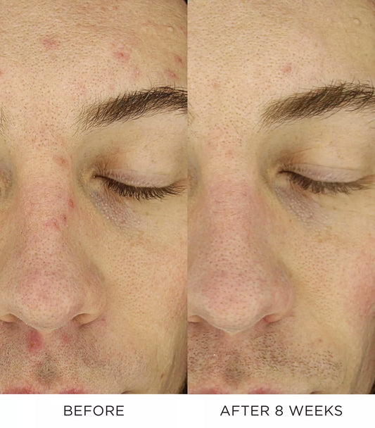 Overnight Chronobiology Peel